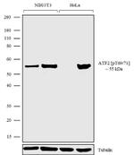 Phospho-ATF2 (Tyr69, Thr71) Antibody in Western Blot (WB)