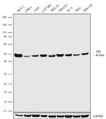 YBX1 Antibody in Western Blot (WB)