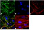 Laminin-221 Antibody in Immunocytochemistry (ICC/IF)