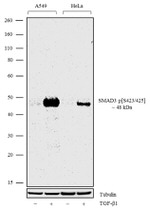 Phospho-SMAD3 (Ser423, Ser425) Antibody