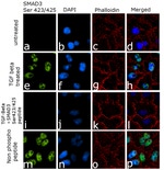 Phospho-SMAD3 (Ser423, Ser425) Antibody