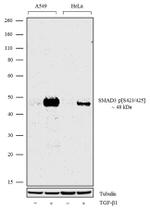 Phospho-SMAD3 (Ser423, Ser425) Antibody in Western Blot (WB)