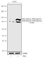 Phospho-RSK Pan (Ser221, Ser227, Ser218, Ser232) Antibody in Western Blot (WB)