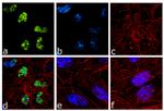 PARP1 Antibody in Immunocytochemistry (ICC/IF)