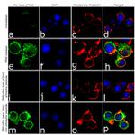 Phospho-PKC beta-1 (Thr642) Antibody in Immunocytochemistry (ICC/IF)