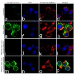 Phospho-PKC beta-1 (Thr642) Antibody