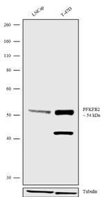 PFKFB2 Antibody in Western Blot (WB)