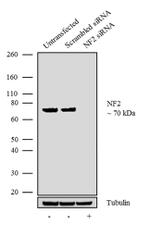 NF2 Antibody in Western Blot (WB)