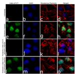 Phospho-CDK6 (Thr177) Antibody in Immunocytochemistry (ICC/IF)