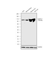 ALDH1L1 Antibody in Western Blot (WB)