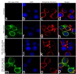 Phospho-PKC beta-1 (Thr642) Antibody