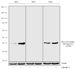 Phospho-PKA alpha/beta (Thr197) Antibody