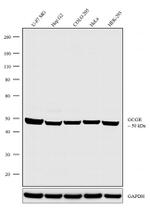 Glucagon Receptor Antibody in Western Blot (WB)