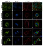 CK1 alpha Antibody