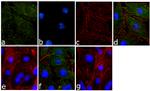 Phospho-MYL9 (Thr18, Ser19) Antibody in Immunocytochemistry (ICC/IF)