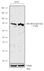 Phospho-PKC beta-1 (Thr642) Antibody in Western Blot (WB)