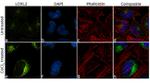 LOXL2 Antibody in Immunocytochemistry (ICC/IF)