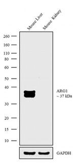 Arginase 1 Antibody