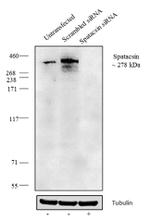 SPG11 Antibody