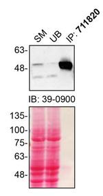 Parkin Antibody in Immunoprecipitation (IP)