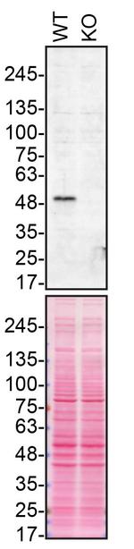 Parkin Antibody in Western Blot (WB)