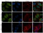 Ataxin 3 Antibody in Immunocytochemistry (ICC/IF)