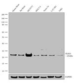 OLIG1 Antibody in Western Blot (WB)