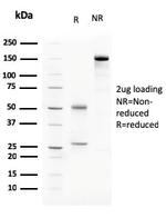 C1QA/Complement C1q A-Chain Antibody in SDS-PAGE (SDS-PAGE)