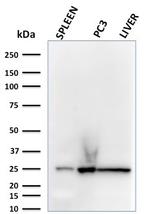 C1QA/Complement C1q A-Chain Antibody in Western Blot (WB)