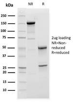 C1QA/Complement C1q A-Chain Antibody in SDS-PAGE (SDS-PAGE)