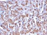 C1QA/Complement C1q A-Chain Antibody in Immunohistochemistry (Paraffin) (IHC (P))