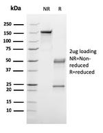 C1QA/Complement C1q A-Chain Antibody in SDS-PAGE (SDS-PAGE)