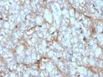 C1QA/Complement C1q A-Chain Antibody in Immunohistochemistry (Paraffin) (IHC (P))