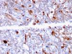 C1QA/Complement C1q A-Chain Antibody in Immunohistochemistry (Paraffin) (IHC (P))