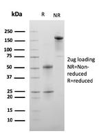 C1QA/Complement C1q A-Chain Antibody in SDS-PAGE (SDS-PAGE)