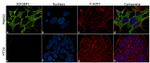 IGF2BP1 Antibody in Immunocytochemistry (ICC/IF)