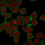 TNF-alpha (Tumor Necrosis Factor alpha) Antibody in Immunocytochemistry (ICC/IF)