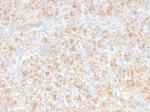 TNF-alpha (Tumor Necrosis Factor alpha) Antibody in Immunohistochemistry (Paraffin) (IHC (P))