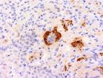 TNF-alpha (Tumor Necrosis Factor alpha) Antibody in Immunohistochemistry (Paraffin) (IHC (P))