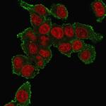 TNF-alpha (Tumor Necrosis Factor alpha) Antibody in Immunocytochemistry (ICC/IF)