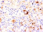 TNF-alpha (Tumor Necrosis Factor alpha) Antibody in Immunohistochemistry (Paraffin) (IHC (P))