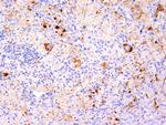 TNF-alpha (Tumor Necrosis Factor alpha) Antibody in Immunohistochemistry (Paraffin) (IHC (P))