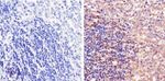 STAT5 beta Antibody in Immunohistochemistry (Paraffin) (IHC (P))