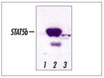 STAT5 beta Antibody in Western Blot (WB)
