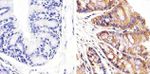 beta Catenin Antibody in Immunohistochemistry (Paraffin) (IHC (P))