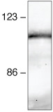 beta Catenin Antibody in Immunoprecipitation (IP)