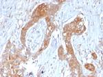 A20/TNFAIP3 Antibody in Immunohistochemistry (Paraffin) (IHC (P))