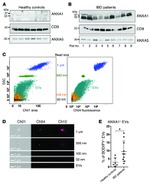 Annexin A1 Antibody in Western Blot (WB)