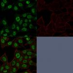 Topoisomerase II alpha (Proliferation and Drug-Resistance Marker) Antibody in Immunocytochemistry (ICC/IF)