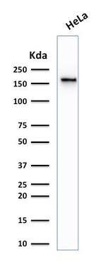 Topoisomerase II alpha (Proliferation and Drug-Resistance Marker) Antibody in Western Blot (WB)